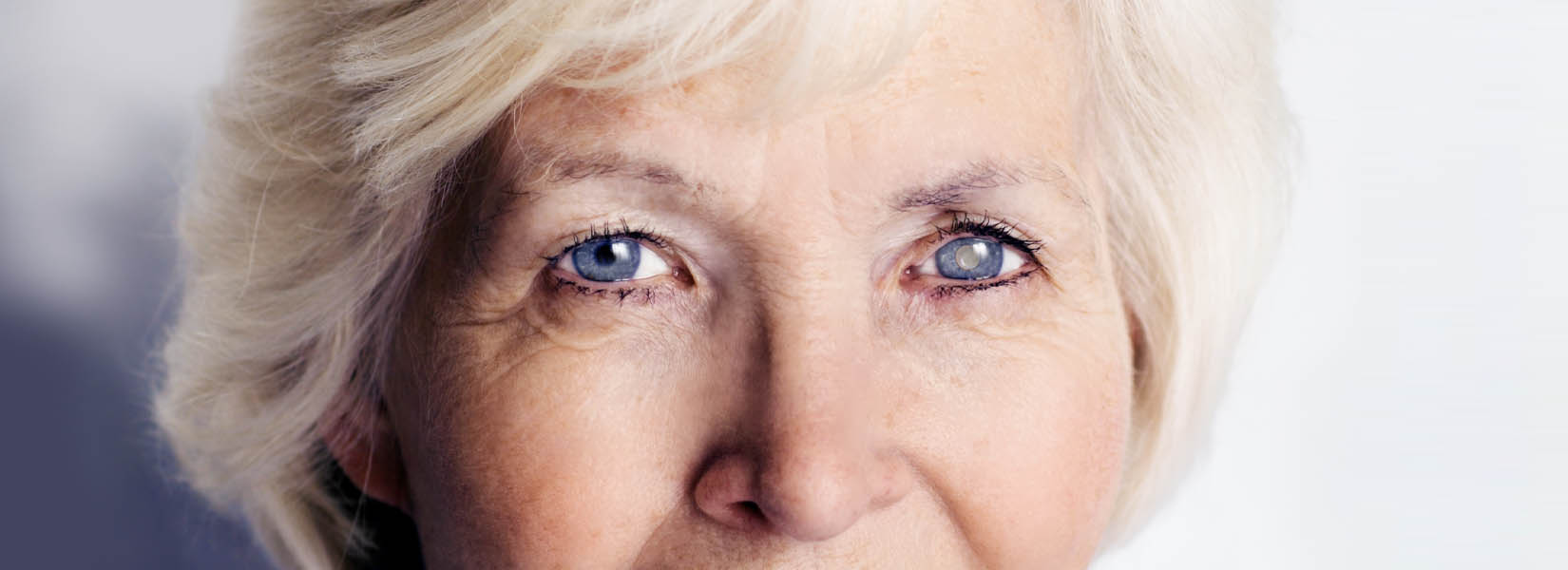 Cataract Surgery in San Tan Ranch