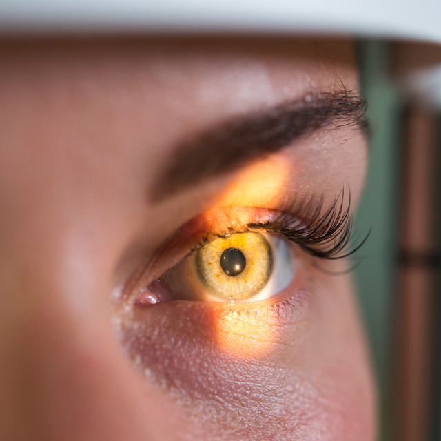 Vision Therapy in San Tan Ranch